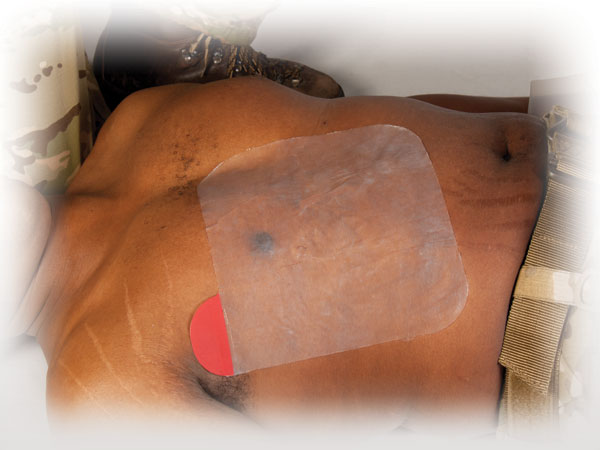 Hyfin Vent Chest Seal Twin Pack