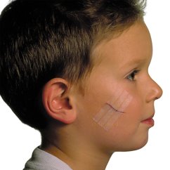 Steri-Strip 3M - náplasťové stehy