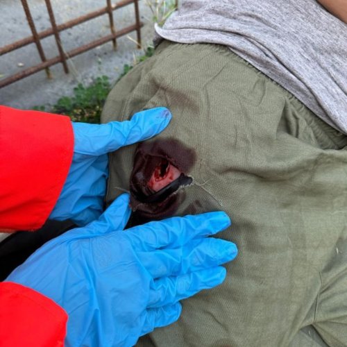 Model pro trénink pakování bodné rány v třísle