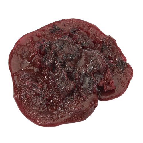 Simulaids Blood Clot Medium - model krevní sraženiny