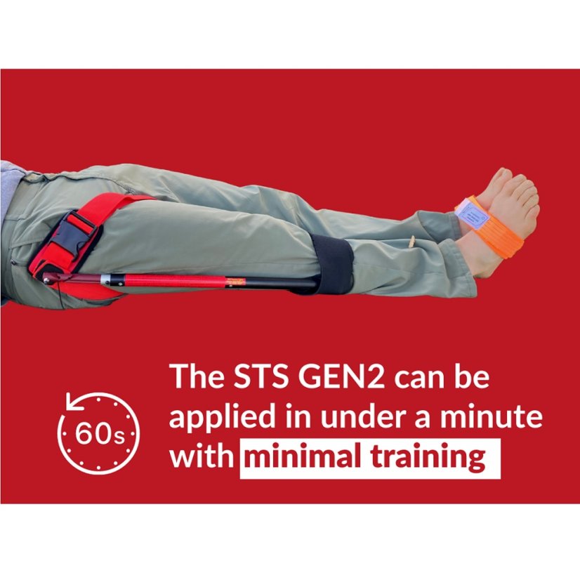 Extenzní trakční dlaha Slishman Traction Splint (STS) GEN 2