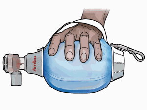 Ambu Mark IV - ruční resuscitátor s rezervoárem