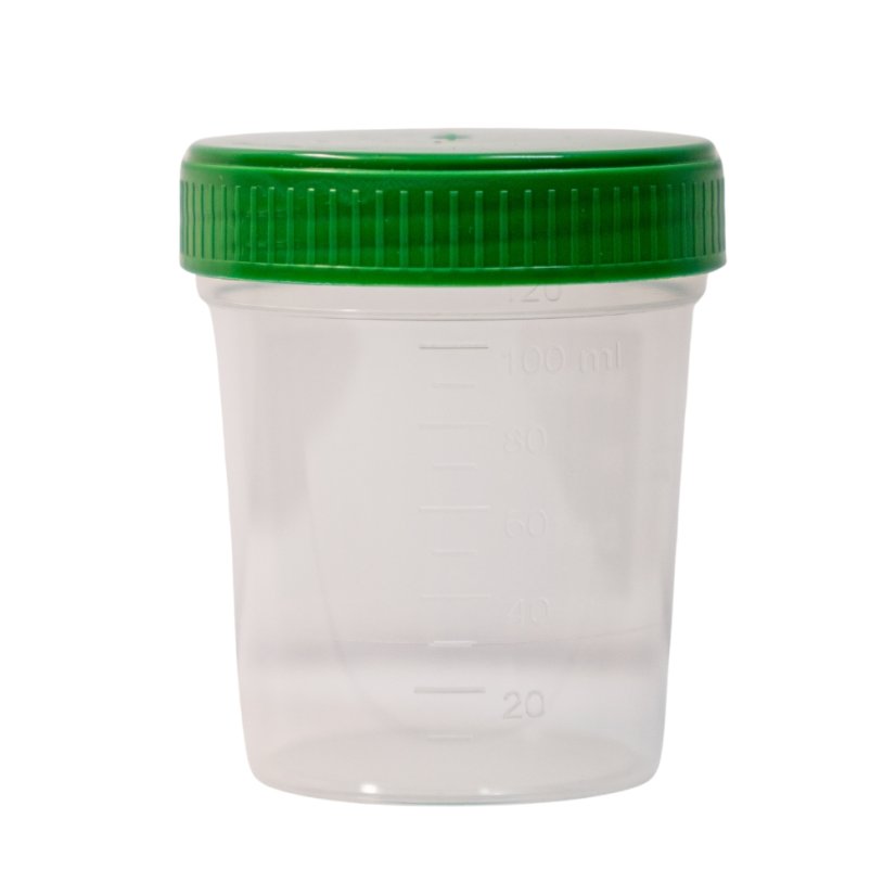 Nádobka na moč nesterilní 120 ml
