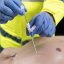 Dekompresní jehla Russell Pneumofix 12G